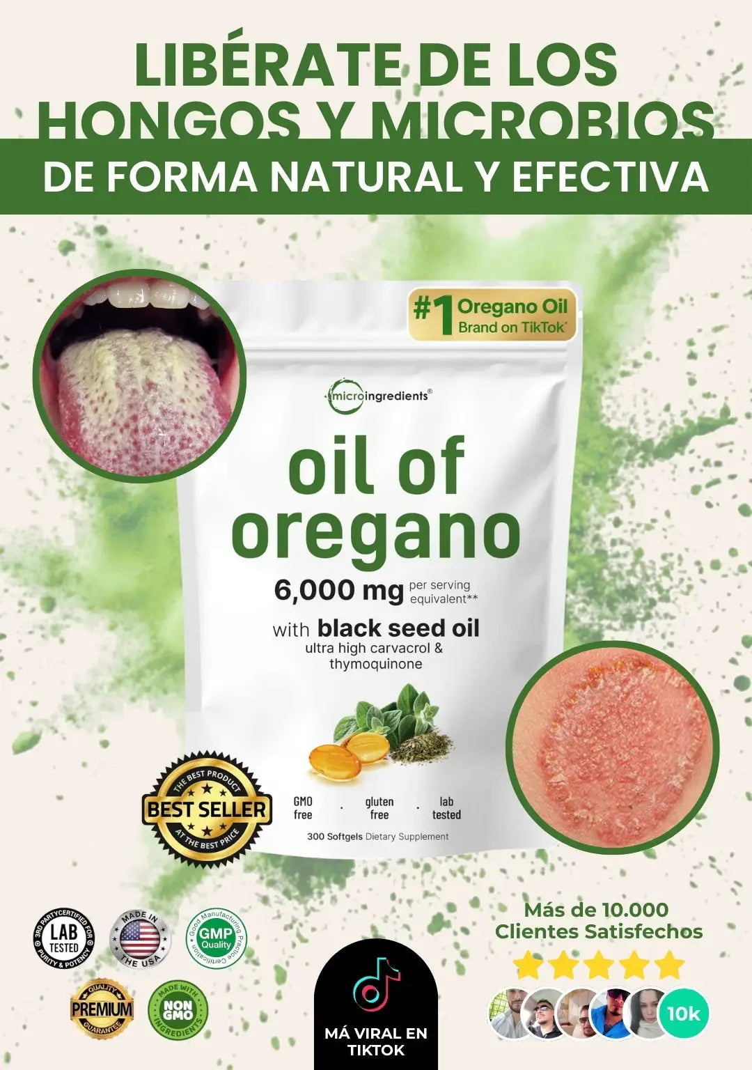 Aceite De Orégano: Libérate de los hongos y microbios 🌿