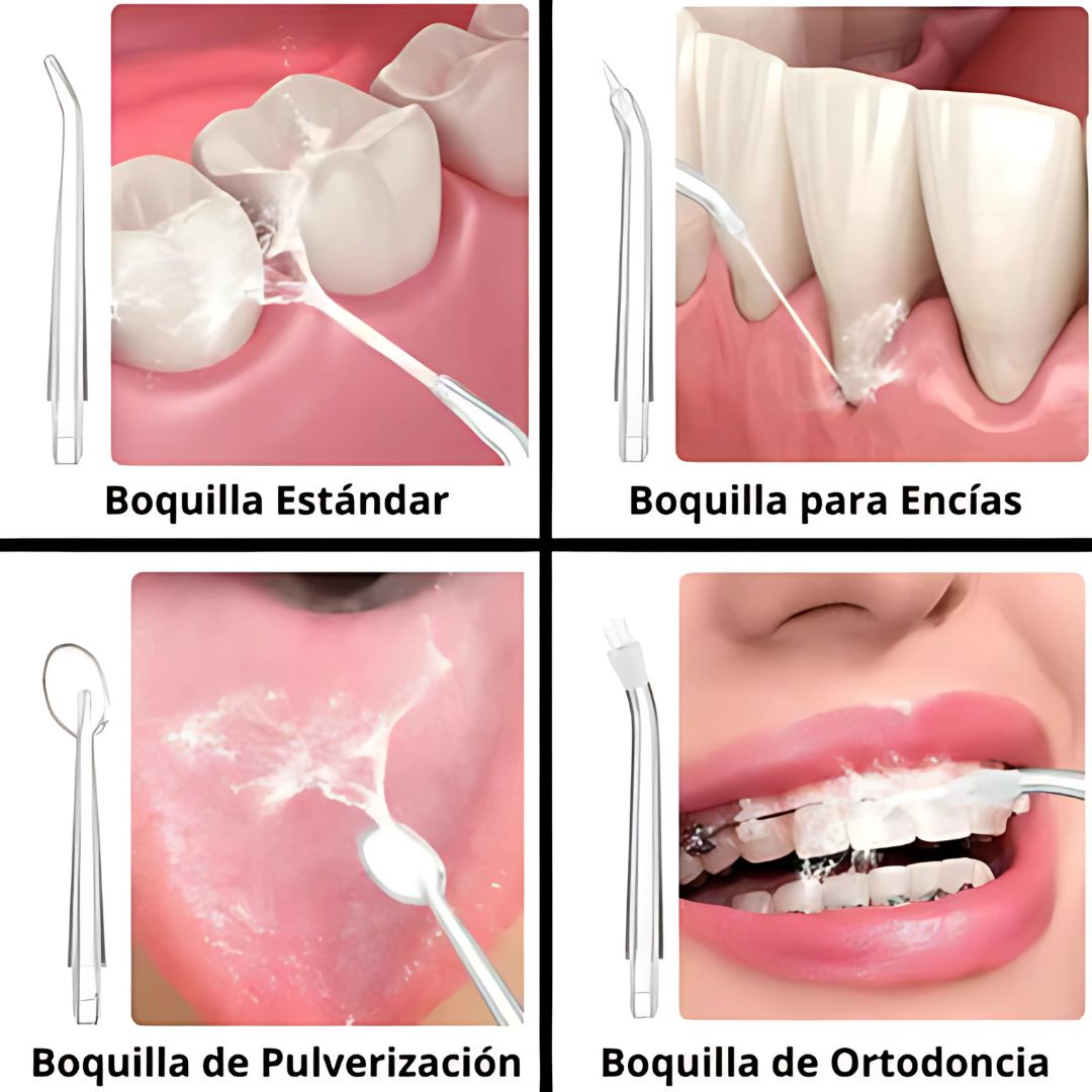 Irrigador Dental Pro✨: Adiós a las caries y al mal olor 😁🦷